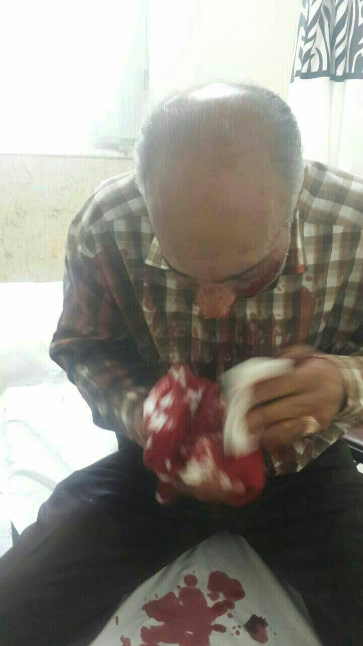یکی از مجروحین حادثه حرم امام/عکس
