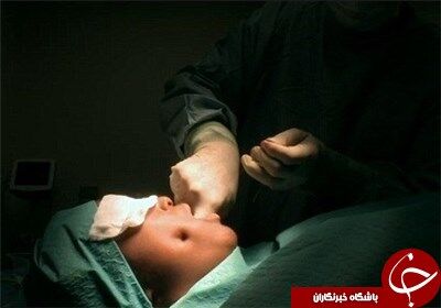 مد این روزها، جراحی چال گونه+تصاویر