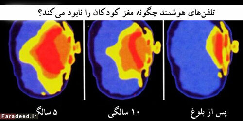 تبلت با مغز کودکان چه می‌کند؟+عکس