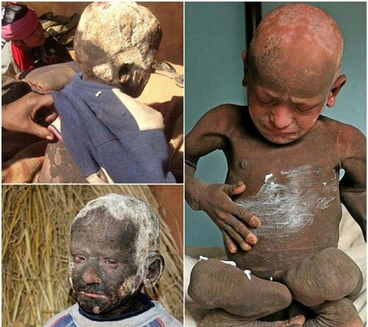 پسری که در حال سنگ‌شدن است!/عکس